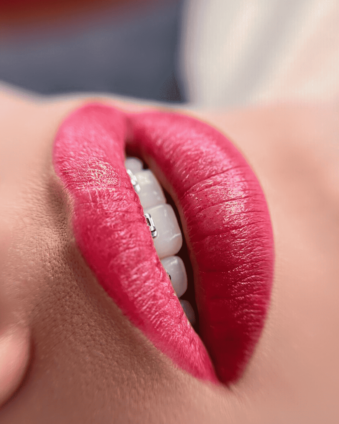 lips (10)